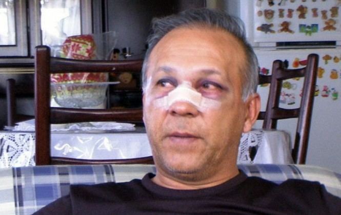 Vladimir Soria Golpea a su tcnico y le fractura la nariz Futbol Sapiens