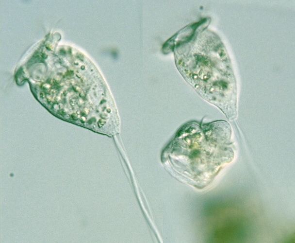 Vorticella Protist as seen in a microscope.