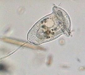 A Vorticella Campanula as seen in a microscope.
