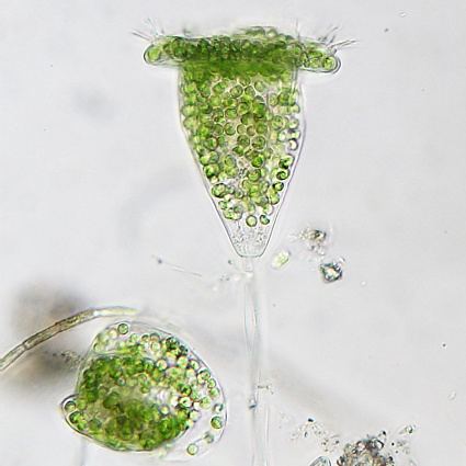 Green Vorticella in a miniature tulip bouquet form as seen in a microscope.