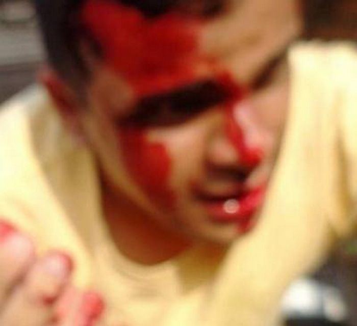 Waldir Pires Brazilian gay politician Waldir Pires Bittencourt attacked