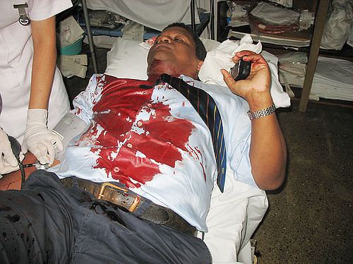 Wavel Ramkalawan 2006 3rd October Wavel Ramkalawan bleeding on the