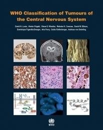 WHO classification of tumours of the central nervous system publicationsiarcfruploadsmediadefault000102