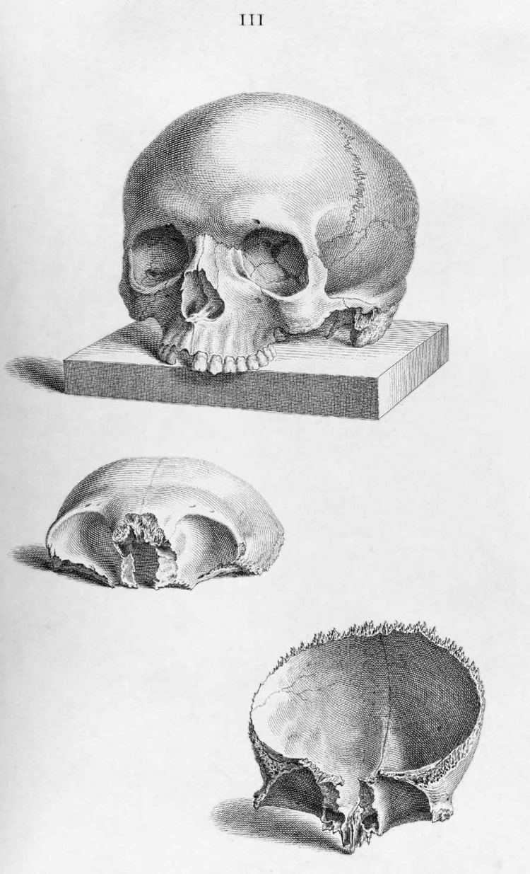 William Cheselden FileWilliam Cheselden skulljpg Wikimedia Commons