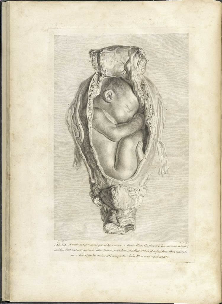 William Hunter (anatomist) Historical Anatomies on the Web William Hunter Home