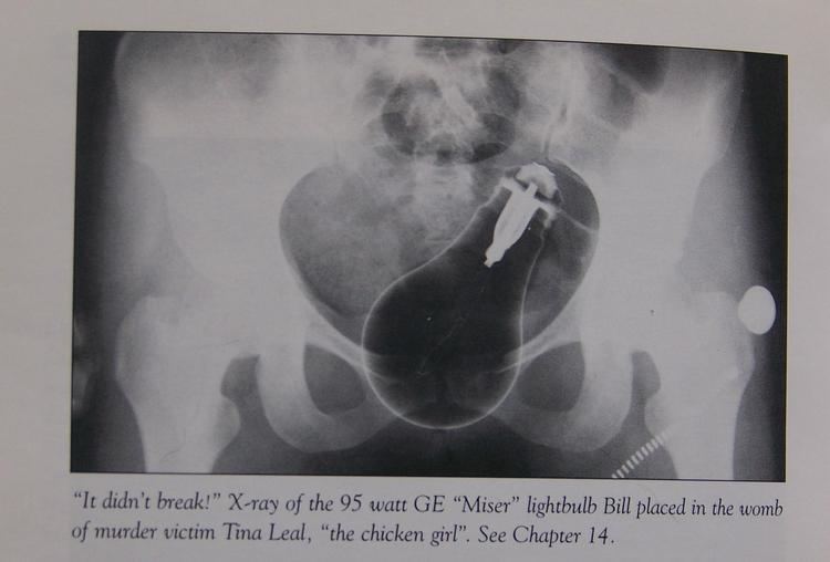 An x-ray of the 95 watt GE lightbulb that William Suff placed in the womb of his murder victim Tin Leal.