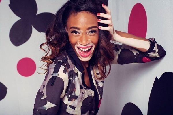 Winnie Harlow ANTM Chantelle BrownYoung on Vitiligo and Reality TV Flare