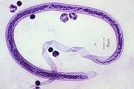A Wuchereria bancrofti roundworm as seen in a microscope.