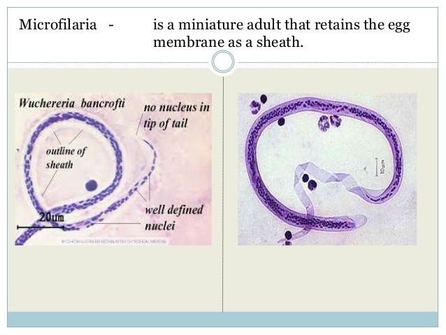 The different parts of a  Wuchereria bancrofti roundworm being identified.