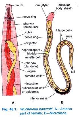 A diagram of the different parts of a female Wuchereria bancrofti roundworm.