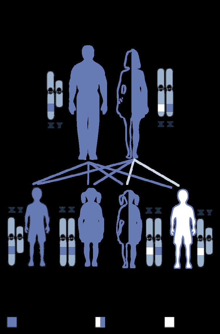 X-linked recessive inheritance