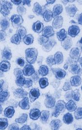 Xenotropic murine leukemia virus-related virus httpsuploadwikimediaorgwikipediacommons55