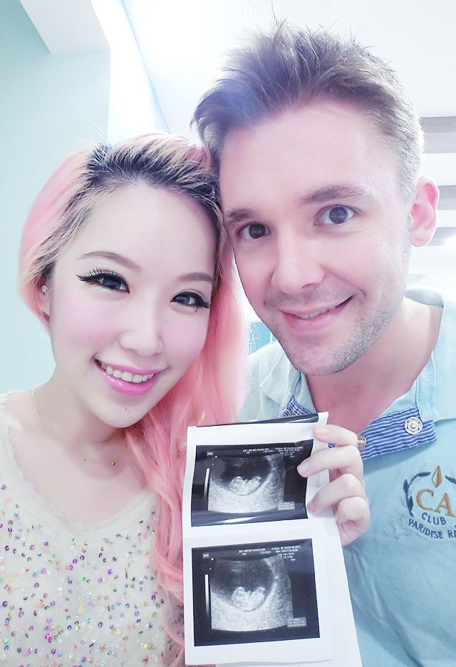 Xiaxue Xiaxueblogspotcom Everyones reading it Expecting a baby