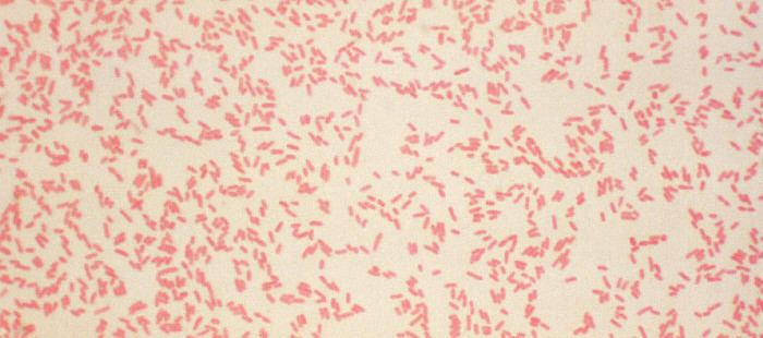 Yersinia enterocolitica Pathogenic Agents Yersinia enterocolitica Barnstable County