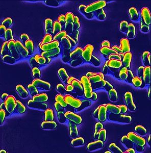 Yersinia pestis Yersinia pestis bacterium Britannicacom