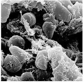 Yersinia pestis Yersinia pestis