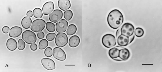 Zygosaccharomyces Ascomycota gtgt Saccharomycetes gtgt Saccharomycetales