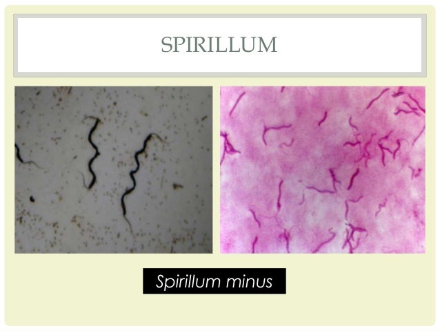Spirillum minus imageslidesharecdncomshapesofbacteria150926123
